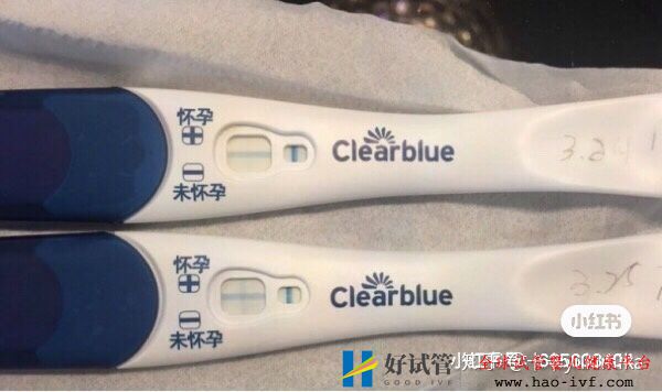 32岁卵巢早衰,通过试管移植一次成功怀孕经验分享(图6) 32岁卵巢早衰,通过试管移植一次成功怀孕经验分享(图6)