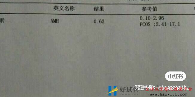 32岁卵巢早衰,通过试管移植一次成功怀孕经验分享(图1) 32岁卵巢早衰,通过试管移植一次成功怀孕经验分享(图1)