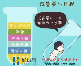试管婴儿的过程步骤