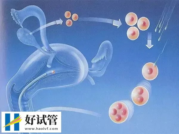 苏州三代试管婴儿费用多少
