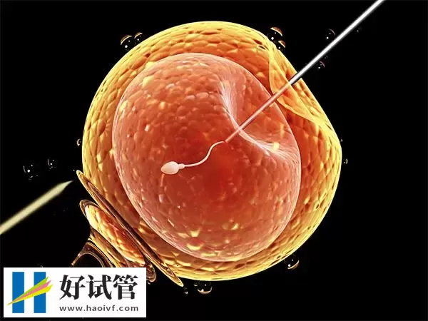 不明原因不孕可不可以做试管婴儿