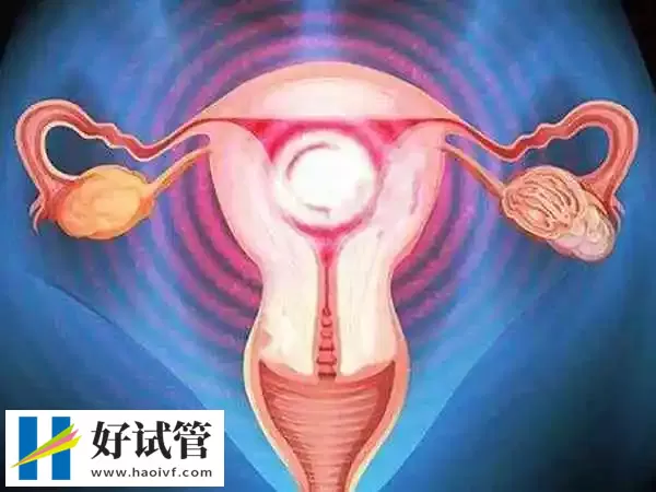 铜仁子宫腺肌症怀孕后保胎的方法是什么