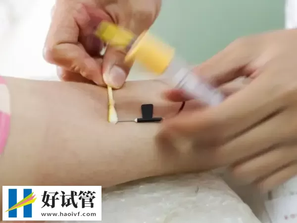 黔南试管婴儿解冻移植前需做哪些检查
