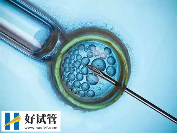 黔西南试管婴儿哪个促排卵方案成功率高