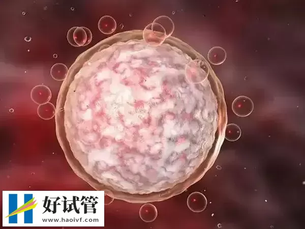 黔西南试管婴儿是否需要监测卵泡