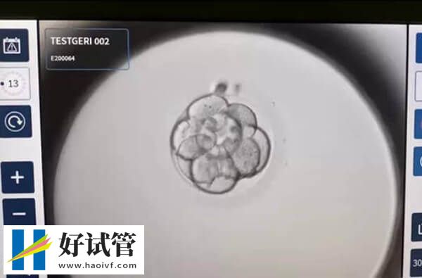 巴中试管婴儿能不能经阴超下进行胚胎移植