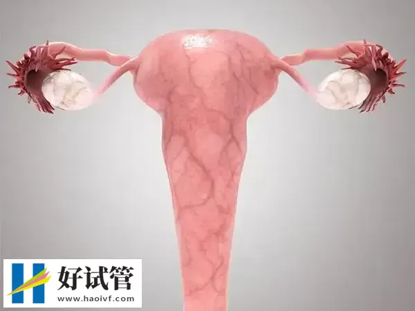 巴中试管婴儿移植后子宫血流不好怎么改善