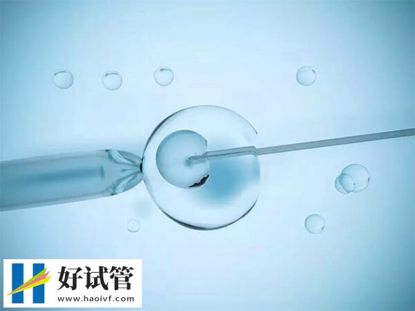 巴中双腔取卵的优势有哪些