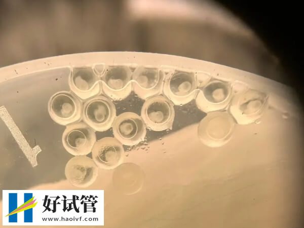 揭秘株洲妇幼是否有卵子库，附供卵试管婴儿价格明细