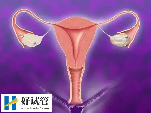 凉山卵巢早衰如何怀孕生孩子