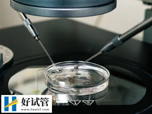 探秘重庆市妇幼保健院人工受孕，附项目收费情况及着床率