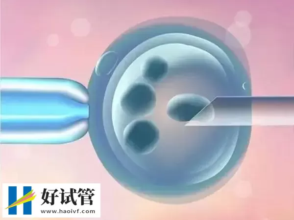 天津供卵试管婴儿多少钱
