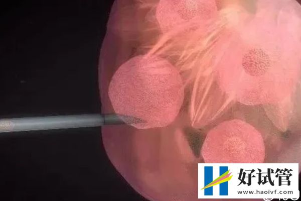 谁说取卵后医生不会发告知胚胎质量的短信，咋样看完就造