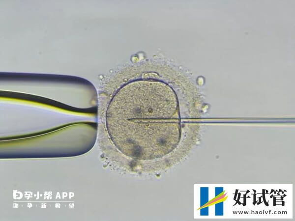 icsi技术是几代试管婴儿(图1) icsi是二代试管婴儿的缩写