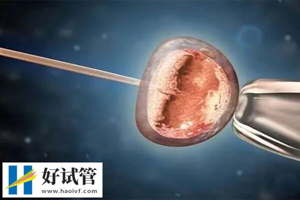 宿迁妇保院试管婴儿龙凤胎需要多少钱