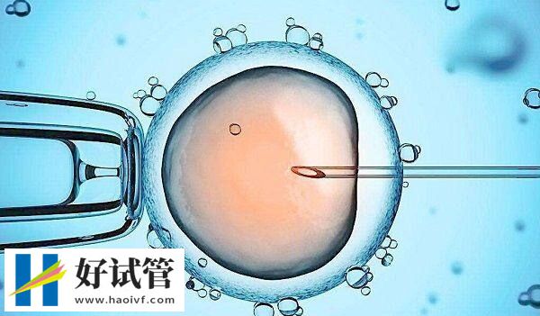 秦皇岛妇幼保健院怎么样？附开展的试管婴儿技术说明