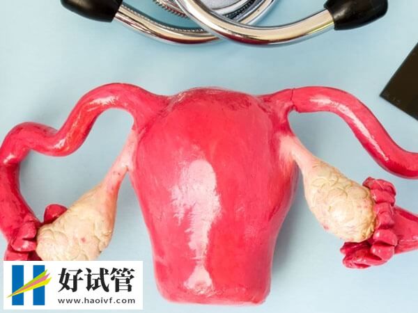 兰州宫腔粘连患者做试管多少钱