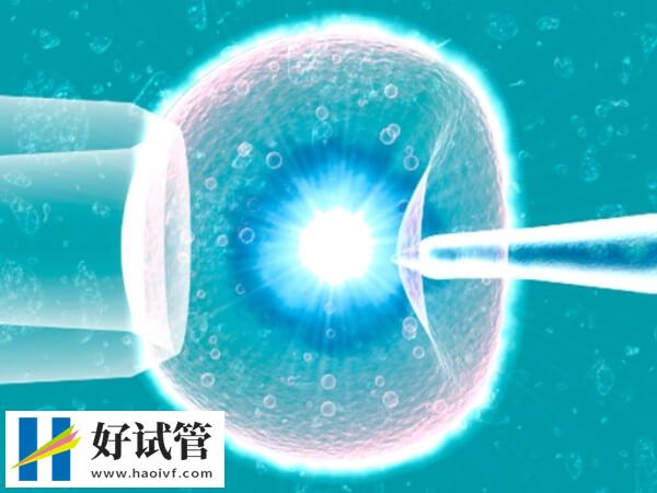 承德做试管婴儿哪个医生好