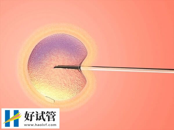大连二代试管费用多少
