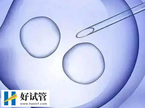 大连做试管婴儿条件是什么