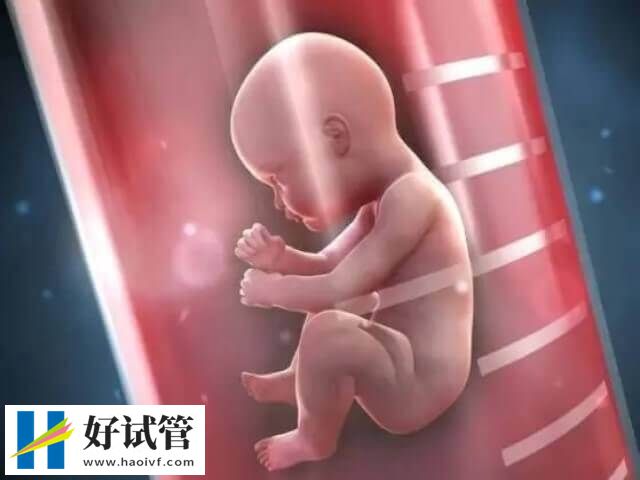 徐州做三代试管有哪些条件