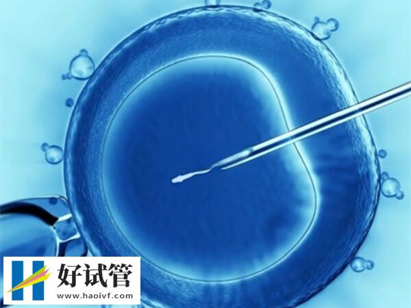 徐州试管成功率高不高