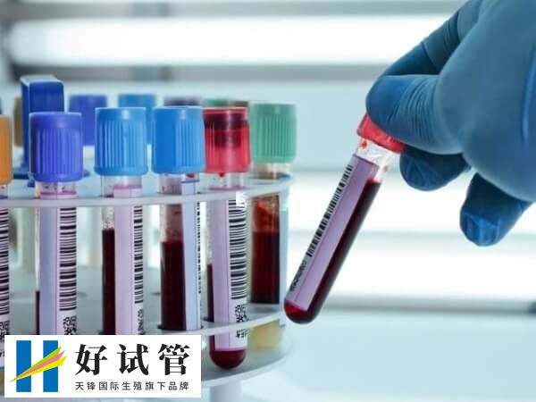 试管移植后还需不需要再去医院(图1) 试管移植14天要抽血检查hcg数值
