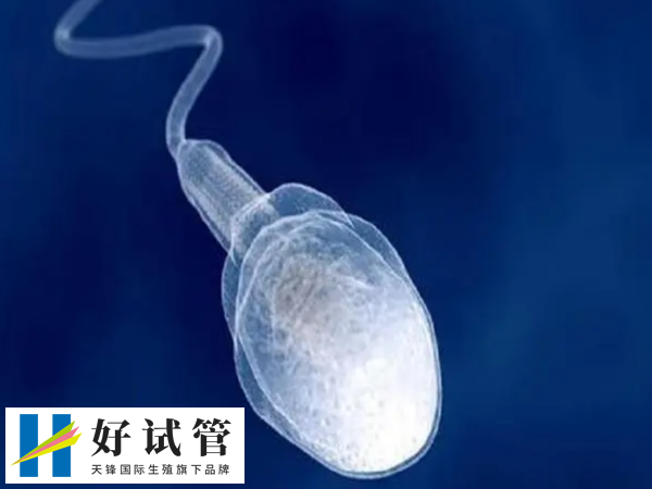 取精要不要钱(图1) 取精需要缴费