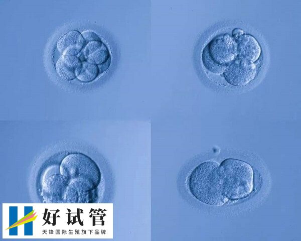 做试管培养囊胚有哪些好处(图2) 养囊可以提高试管移植成功率