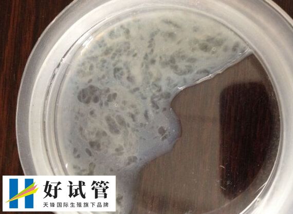 穿刺取到C级精子能否做试管婴儿(图2) C级精子做试管的成功率并不能一概而论