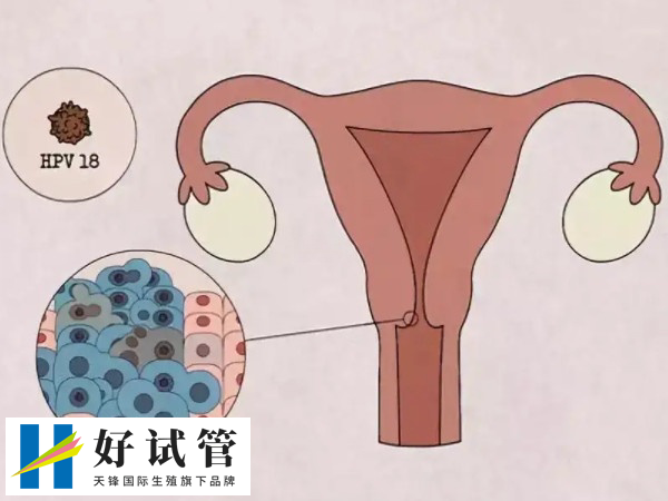 女性做血沉检查后实施试管有无影响(图1) 血沉检查对试管婴儿成功率可能有影响