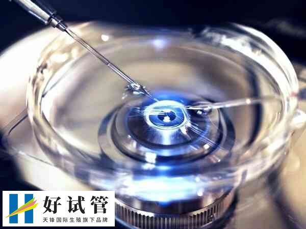 取卵后一个月卵巢是否恢复了(图2) 试管婴儿取卵是有创手术