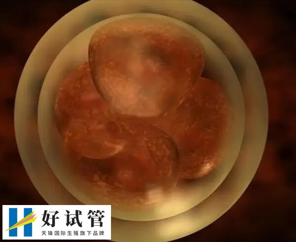 肥胖对试管有什么影响(图1) 肥胖会影响卵子质量