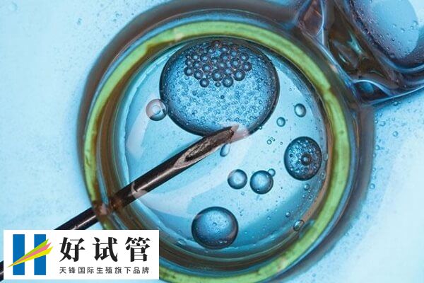 做试管对amh值有没有要求(图1) amh值通常与年龄成反比关系