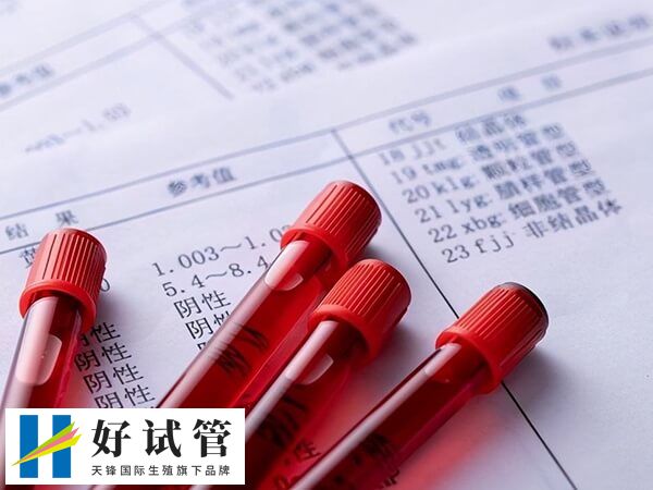 做试管对amh值有没有要求(图2) 低于1.5ng/ml说明卵巢储备功能下降