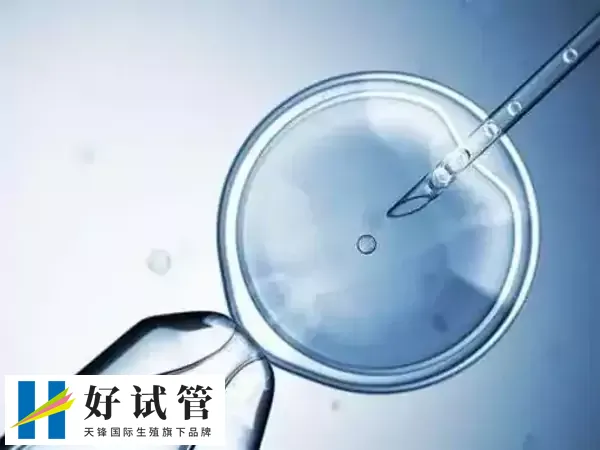 格鲁吉亚试管技术好不好