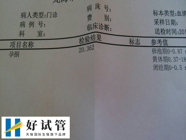 检查孕酮和hCG有意义