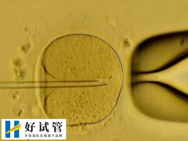 胚胎移植成功率和什么有关系(图1) 囊胚移植成功率高