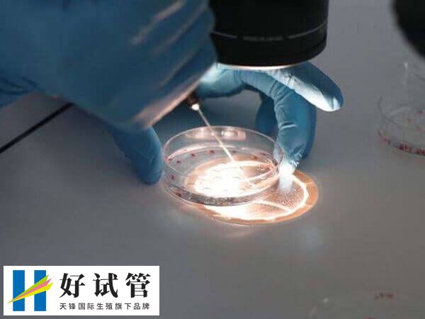 囊胚培养失败有什么原因(图2) 养囊之后是否成功都是要收取一定费用的