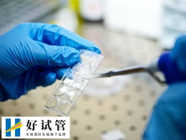 无痛取卵会不会影响卵子质量(图1) 试管取卵过程10-15分钟