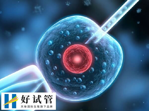 取卵手术的过程是什么