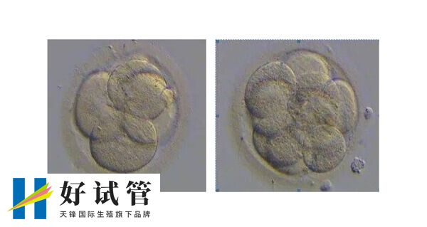 试管婴儿优胚和普胚的区别有哪里