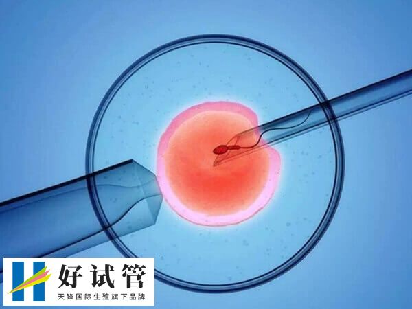 取卵手术会怎么麻醉(图1) 试管婴儿手术前需要取卵