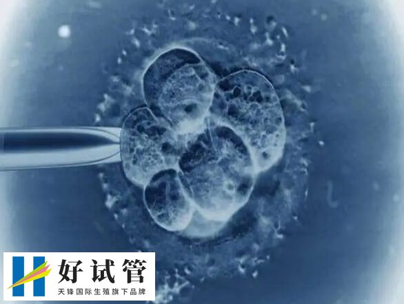 降调卵泡不均匀是怎么回事(图1) 造成卵泡发育大小不均匀的因素有很多的