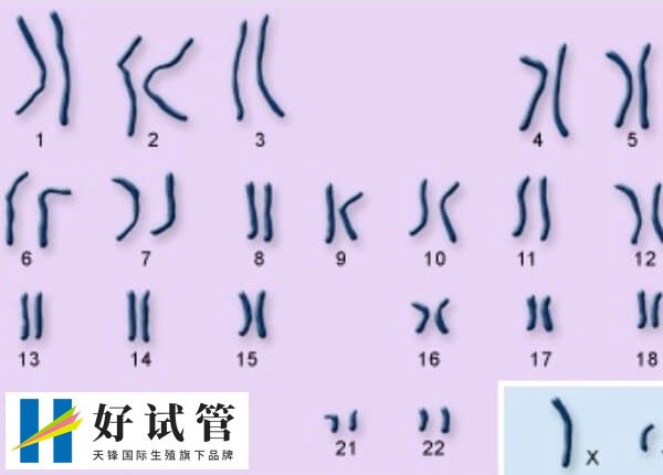 染色体cnv缺失是什么意思(图2) 染色体CNV缺失是基因组结构变异的一种形式