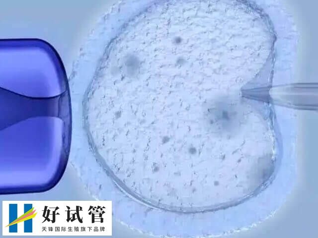 试管短方案取卵会不会少儿短方案取几个卵？