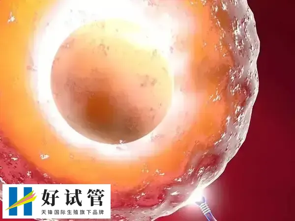 试管移植选龙凤胎要多少钱