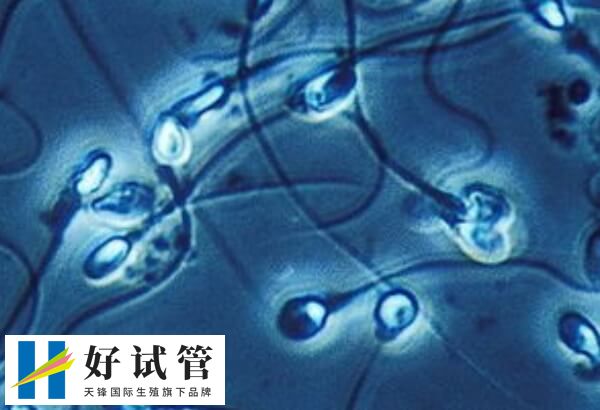 导致男性不孕不育症的原因有哪些(图2) 精子抗体也会导致男性不孕不育