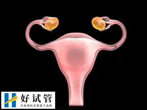 宫腔粘连做试管婴儿是否有影响