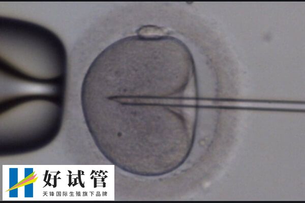 促排卵泡质量不好的原因有哪些